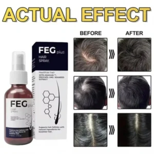 1 Pcs FEG Plus Hair Growth Spray 50ml